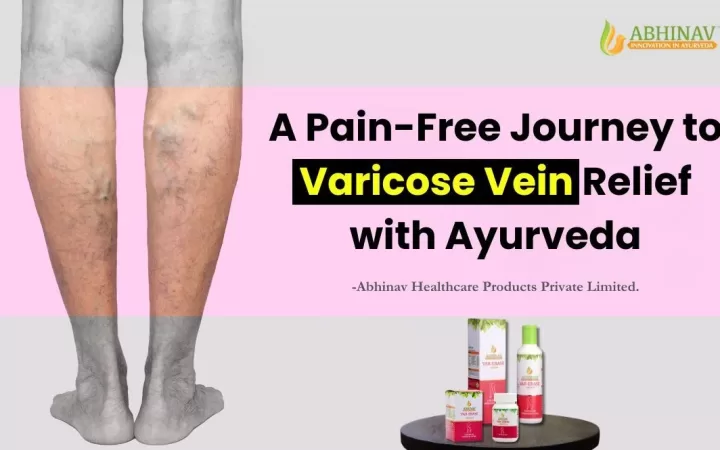 Ayurvedic Medicine for Varicose Veins