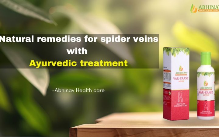 Natural-remedies-for-spider-veins-with-Ayurvedic-treatment